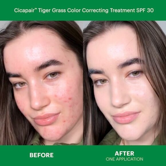 NEW Dr. Jart+ Cicapair Redness Rescue Kit for Sensitive Skin Set/100%AUTHENTIC - Picture 4 of 11